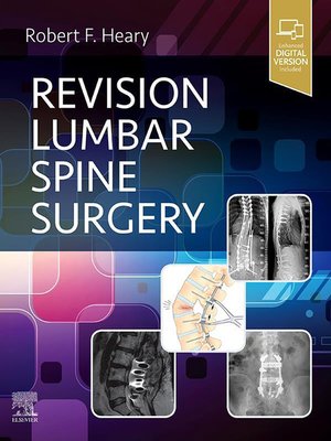 cover image of Revision Lumbar Spine Surgery